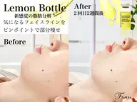 韓国発🇰🇷🍋美容液導入💆‍♀️🍋二重顎フェイスライン特化！