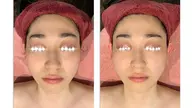 ぷるぷる極上美肌コース