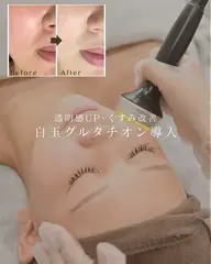 【透明感UP★くすみ改善】白玉グルタチオン導入フェイシャル️🫧☁*