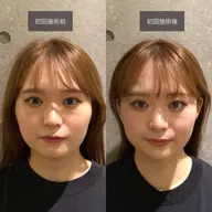 あっという間に小顔に🌟【大人女性に人気！小顔矯正コース】（45分）11,000円→1,500円(税込)