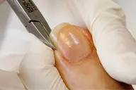 【はじめての方限定】ドイツ式フットケア(お爪のケア)カット/甘皮ケア/汚れお掃除/透明マニキュア仕上げ