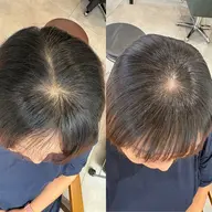 【生えぐせ改善】ヘアリセッター+カット
