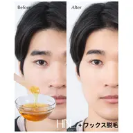 【初回/男性限定】HBL + ワックス脱毛Mini