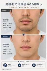 🔷メンズ ヒゲ
