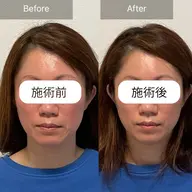 頭蓋骨・小顔矯正