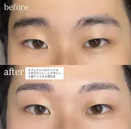 minimo限定🦋ᩚ【セットメニュー】全顔フェイシャルワックス+眉フルメニュー