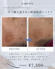 お悩みに合わせ、毛穴・シミ・小顔から最適な施術をオーダーメイドで施術。未来の輝く肌のために、プロの視点で最短距離のご提案