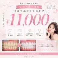 【定額⟡通い放題】🪞ᩚセルフホワイトニング ¥11,000/月