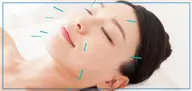 Ｍｅｄｉｃｕｒｅ式美容鍼+頭蓋骨矯正  ※初回限定