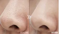 大人気‼️＼憧れの“毛穴レス肌”へ✨／角栓やゴワつきをやさしくケア✨固くなったお肌をほぐして、プルンッとした陶器肌へ導く