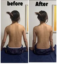 【minimo限定】minimo等掲載可能beforeafterモデル 背中、腕ロミロミ肩甲骨＋ドライヘッド30分
