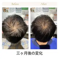 【初回限定68%オフ】頭皮診断+頭皮スカルプケア60分