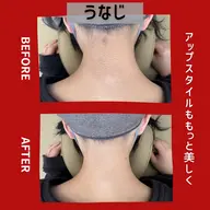 【女性人気】うなじ脱毛