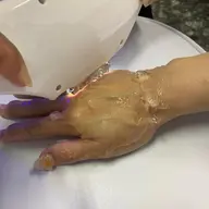 光ハンドケア