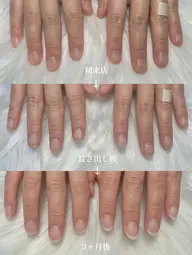 【長さ出し有り】深爪・自爪育成クリアジェル