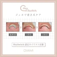 巻き爪ケア1本【Hey Switch】