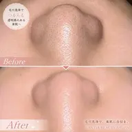 👃鼻だけ毛穴洗浄🫧初回¥3,500🤍
