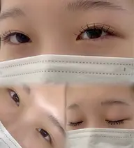 🩵ミニモ学割U24 フラットラッシュ80本🩵