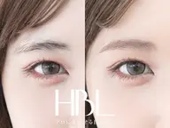 HBL ハリウッドブロウリフト