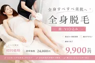 【ミニモ限定|女性専用】全身脱毛✨顔・VIO込み《まるごと全身》
