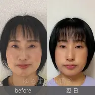 エステの枠を超えた変化♡優しいタッチの小顔矯正【頭蓋骨調整＋タルミ解消フェイシャル＋頭蓋骨ケア】65分 半額の6500円