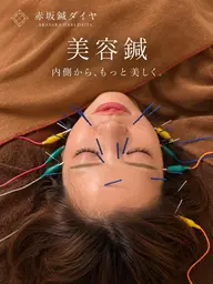 【インスタグラマーご来店メニュー✨】同じ美容鍼を体験