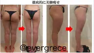 【下半身集中スリム】気になるヒップ・太もも・むくみ・冷え悩みに徹底部分集中コース!