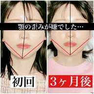 minimo特別❣️あご＋頭蓋骨小顔ケア 💆🏻‍♀️ 顔の歪み 全部込み❤️ お試しパーフェクトコース