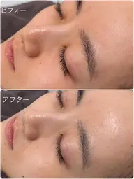 練習モデル🎀【NEW】発酵トーニング꙳⟡透明感up🤍⚠️10/30限定!