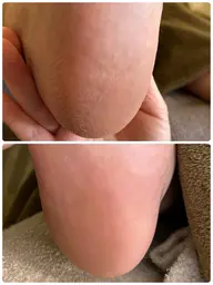 足裏角質ケア フットバス+足裏の角質ケア+保湿付き✨