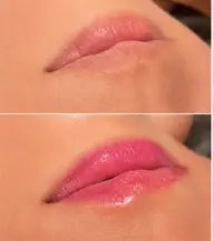 ピンクトーンリップ(唇)ケア