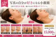 【月5名限定】顔痩せモニター｜二重あご・頬肉・たるみ改善60分
