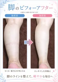 《美容整体》違いがでる脚・ヒップケア✨