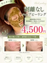 【モニター割】剥離なしハーブピーリング🌿痛み・ダウンタイムなし✨※施術前後や動画撮影にご協力いただける方