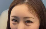 フラットラッシュ140本🌼＋1,100円でLEDに変更可能※マツエクオフ代別途あり補足説明ご覧ください