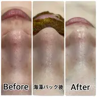【新規男女/花粉や皮脂対策で透明肌へ】全顔3D毛穴洗浄体験¥5500