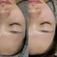 艶肌WAX(お顔)+水光パック