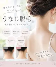 うなじ脱毛