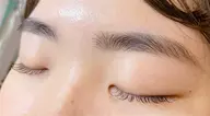 エクステオフのみ