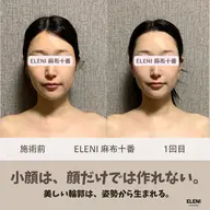 🎁口コミ投稿で施術10分延長✨写真写りをもっと美しく✨頭蓋骨小顔矯正×姿勢矯正120分|麻布十番プライベートサロン