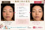 【うるツヤ美肌】ひんやりモデリングパックフェイシャル60分|毛穴・乾燥・肌ケアに✨