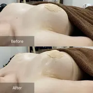 体験メニュー バスト、ウエスト、ヒップ、脚などの部位から選べる