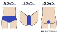 VIO脱毛