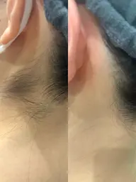 うなじWAX