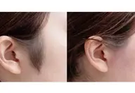 🎀💜口まわり産毛➕もみあげWax脱毛¥2800✨美容液コーティング付き✨💜🎀