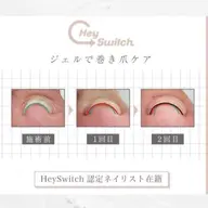 【巻き爪・食い込み改善】特殊ジェル巻き爪ケア✨
