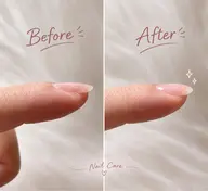 ビルダージェル厚み出し・フォルム形成