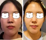 ■ 美ボディリリース➕頭小顔美骨コルギ 60分Massage to make your face smaller
