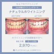 【限定クーポン❣️お試しコース】自然なツルピカ歯になります🦷✨ ナチュラルセルフホワイトニング(30分)