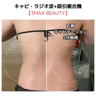 【新定番！結果を出すならコレ】プレミアムカスタマイズ痩身120分 通常¥26800→¥12000